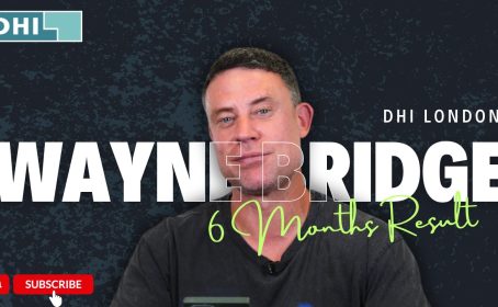 Wayne-Bridge-hair-transplant